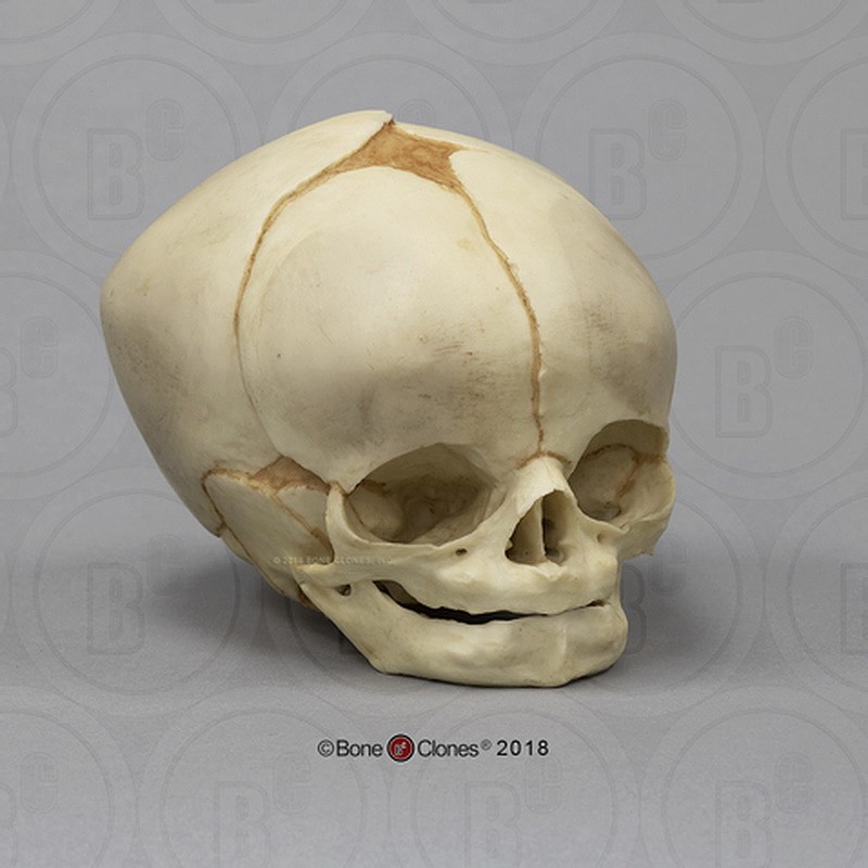 人类测量标准颅骨