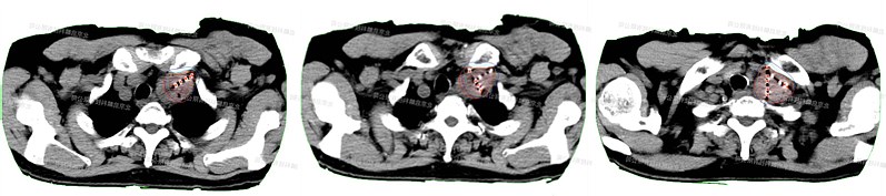 guangyieryuan2.jpg